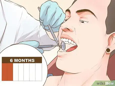 Image titled Have Great Teeth Step 6