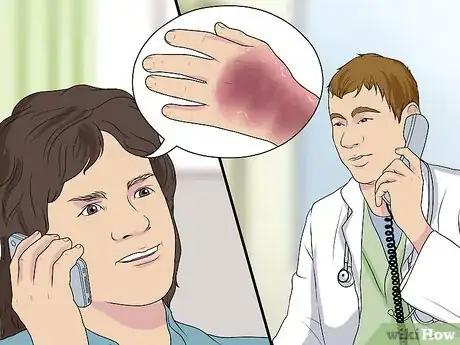 Image titled Diagnose Erythrodermic Psoriasis Step 7