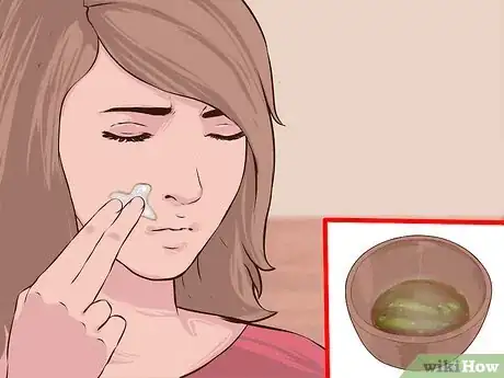Image titled Treat Acne Scars with Aloe Vera Step 8