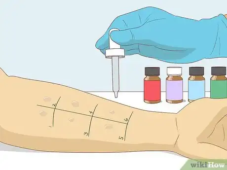 Image titled Treat Mast Cell Activation Syndrome Step 8