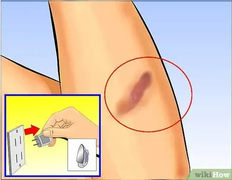 Image titled Use Aloe Vera to Treat Burns Step 1