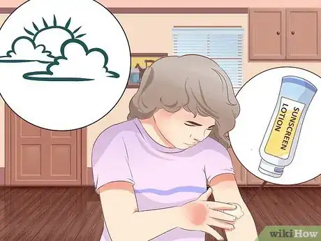 Image titled Prevent Skin Cancer for Kids Step 4