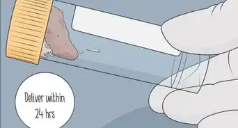 Store a Stool Sample