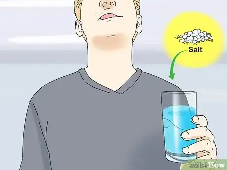 Image titled Clean Wisdom Teeth Step 12