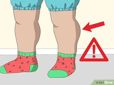 Image titled Diagnose Muscular Dystrophy Step 5