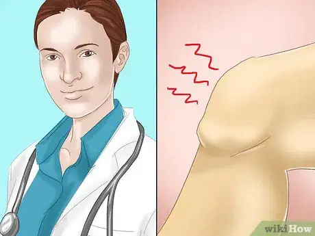 Image titled Get Rid of Knee Pain from Running Step 10