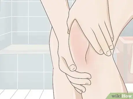 Image titled Reduce Yeast in Your Body Step 25