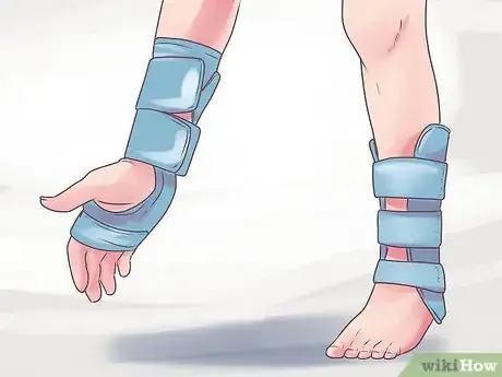 Image titled Treat Degenerative Arthritis Step 6