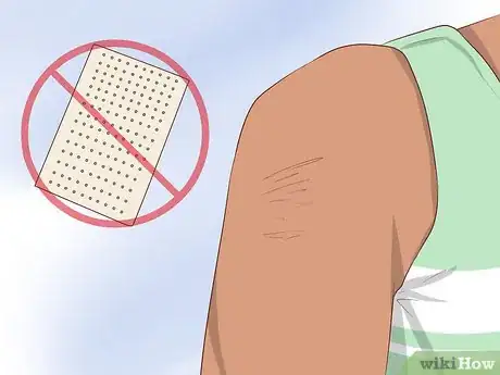 Image titled Use Cayenne for Back Pain Step 5