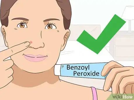 Image titled Get Rid of a Pimple Step 5
