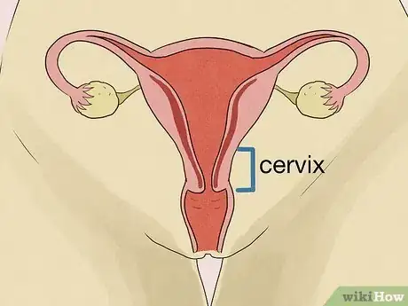 Image titled Deal with Soreness After Sex Step 2