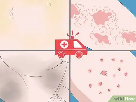 Image titled Care for Mature Skin Step 22