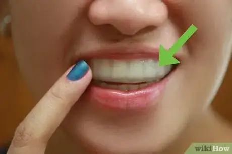 Image titled Make a Fake Retainer Out of Wax Step 9