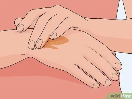 Image titled Use Chamomile As a Fungal Treatment Step 2