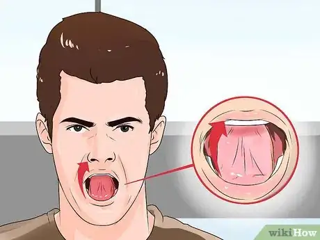 Image titled Cure Brainfreeze Step 1