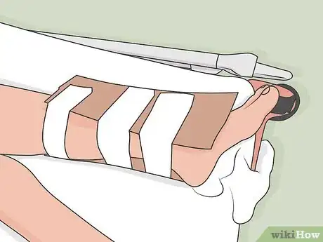 Image titled Diagnose and Treat a Tibial Plateau Fracture Step 02