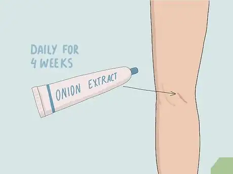 Image titled Heal Skin Naturally Step 7