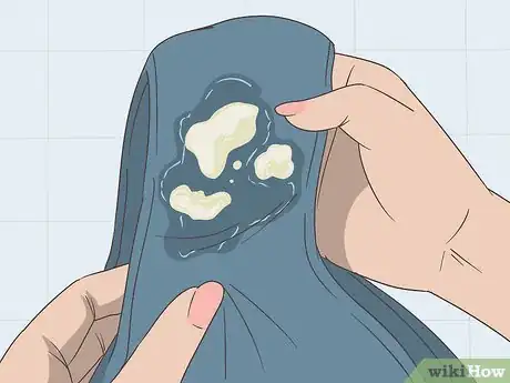 Image titled Diagnose a Yeast Infection at Home Step 16