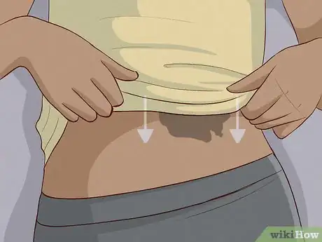 Image titled Deal With Birthmarks Step 11