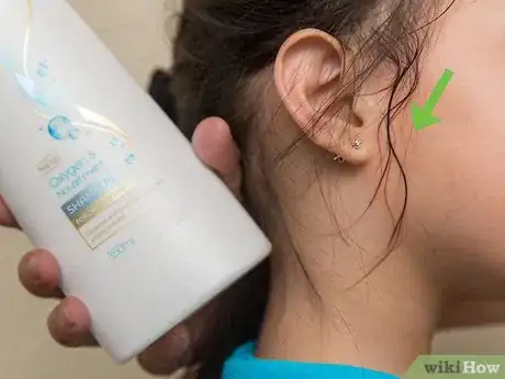 Image titled Remove Kool Aid from Skin Step 7