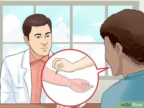 Image titled Recognize and Prevent Valley Fever (Coccidioidomycosis) Step 7