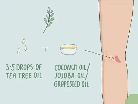 Image titled Heal Skin Naturally Step 3
