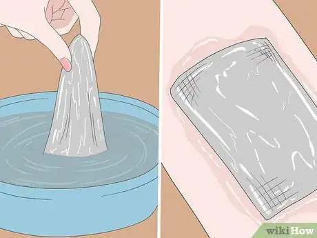 Image titled Treat Poison Ivy Blisters Step 2