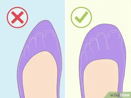 Image titled Remove Spider Veins Step 4