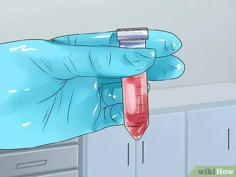 Image titled Know if You Have Thyroid Disease Step 11