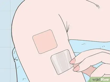 Image titled Use a Contraceptive Patch Step 11