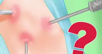 Get Rid of Knee Pain from Running