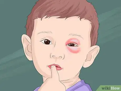 Image titled Know When to Call the Doctor If Your Baby or Child Is Sick Step 8