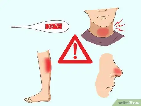Image titled Test for the Flu Step 1