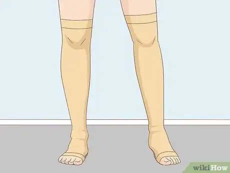 Image titled Remove Spider Veins Step 5