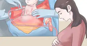 Decide Whether to Have a C Section