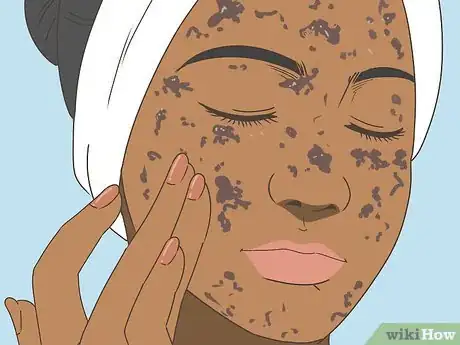 Image titled Buy a Dermaroller Step 10