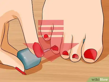 Image titled Get Rid of Yellow Toenails Step 7