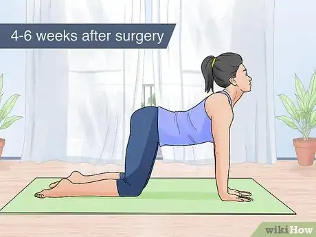 Image titled Minimize the Risks of Cosmetic Surgery Step 13