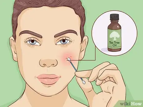 Image titled Treat Skin Conditions with Tea Tree Oil Step 6