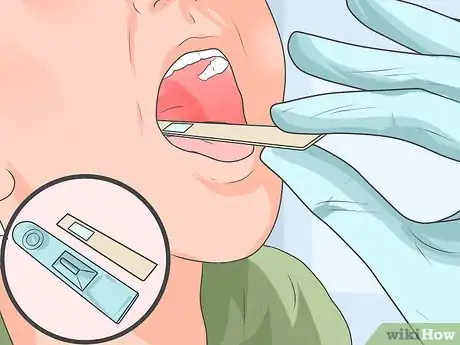 Image titled Take a Throat Culture Step 7