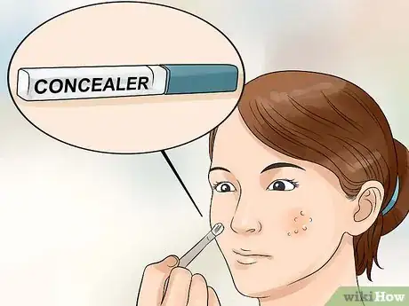 Image titled Hide Pimples Step 9