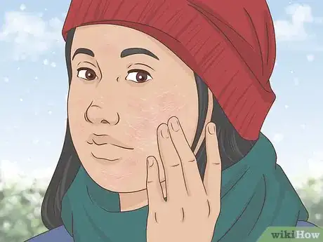 Image titled Choose Between a Moisturizer or Hydrator for Your Skin Step 4