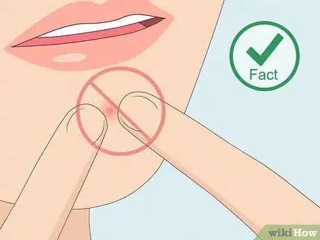 Image titled Myths About Pimples Step 8