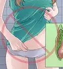 Treat Vaginal Cysts