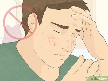 Image titled Be Confident If You Have Acne Step 11