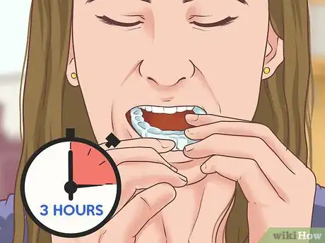 Image titled Use Prescription Gel to Whiten Teeth Step 4