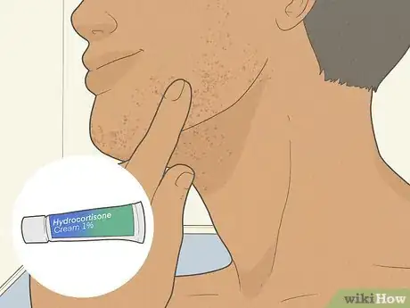 Image titled Get Rid of Razor Burn Fast Step 16