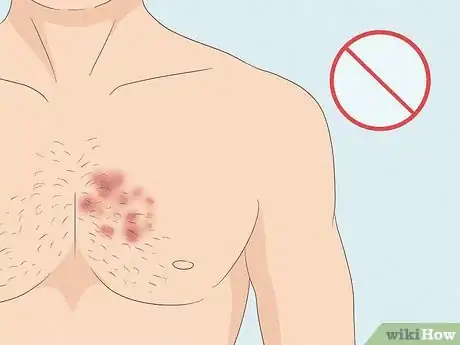 Image titled Prepare Skin for Hard Wax Step 5