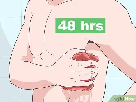 Image titled Treat Bruised Ribs Step 6