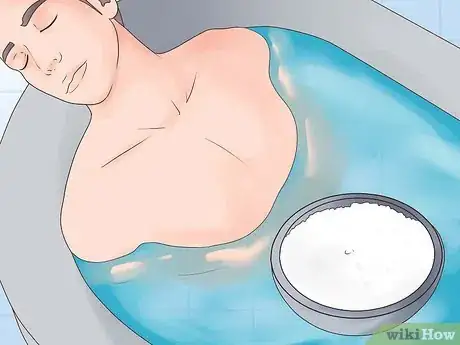 Image titled Treat Swelling Step 10